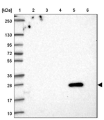 FA156 Antibody in Western Blot (WB)