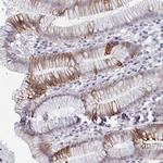 FA156 Antibody in Immunohistochemistry (Paraffin) (IHC (P))