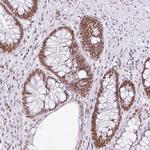 FAM122A Antibody in Immunohistochemistry (Paraffin) (IHC (P))