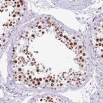 FAM122A Antibody in Immunohistochemistry (Paraffin) (IHC (P))