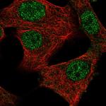 MED11 Polyclonal Antibody