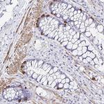 MED11 Antibody in Immunohistochemistry (Paraffin) (IHC (P))