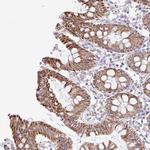 NT5C1B Polyclonal Antibody