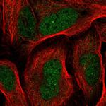 RDH14 Polyclonal Antibody