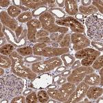 RDH14 Antibody in Immunohistochemistry (Paraffin) (IHC (P))