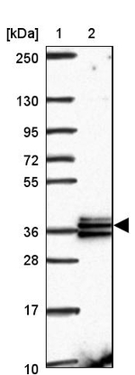 RDH14 Antibody in Western Blot (WB)