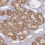 L3HYPDH Antibody in Immunohistochemistry (Paraffin) (IHC (P))