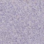 L3HYPDH Antibody in Immunohistochemistry (Paraffin) (IHC (P))