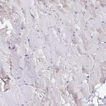 L3HYPDH Antibody in Immunohistochemistry (Paraffin) (IHC (P))