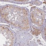 L3HYPDH Polyclonal Antibody