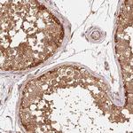STRN4 Antibody in Immunohistochemistry (Paraffin) (IHC (P))