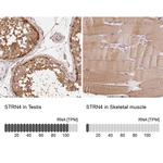STRN4 Antibody in Immunohistochemistry (IHC)