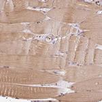 STRN4 Antibody in Immunohistochemistry (IHC)