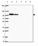 STRN4 Antibody in Western Blot (WB)