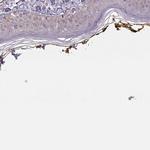 PLA2G4F Antibody in Immunohistochemistry (IHC)