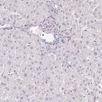 PLA2G4F Antibody in Immunohistochemistry (IHC)