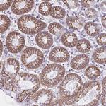 OR51M1 Antibody in Immunohistochemistry (Paraffin) (IHC (P))