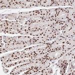 CCDC12 Antibody in Immunohistochemistry (Paraffin) (IHC (P))