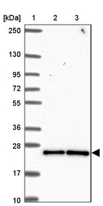 CCDC12 Antibody in Western Blot (WB)