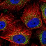 MIA3 Polyclonal Antibody