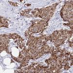 MIA3 Antibody in Immunohistochemistry (Paraffin) (IHC (P))