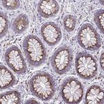 MIA3 Antibody in Immunohistochemistry (Paraffin) (IHC (P))