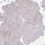 MIA3 Antibody in Immunohistochemistry (Paraffin) (IHC (P))