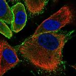 EPB41L1 Polyclonal Antibody