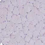EPB41L1 Antibody in Immunohistochemistry (Paraffin) (IHC (P))