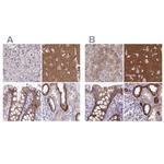 EPB41L1 Antibody in Immunohistochemistry (IHC)