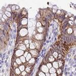 EPB41L1 Antibody in Immunohistochemistry (IHC)