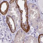 EPB41L1 Antibody in Immunohistochemistry (IHC)