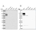 EPB41L1 Antibody in Western Blot (WB)