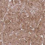 TRIM52 Antibody in Immunohistochemistry (Paraffin) (IHC (P))