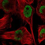 hnRNP DL Polyclonal Antibody