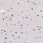 hnRNP DL Antibody in Immunohistochemistry (Paraffin) (IHC (P))
