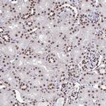 hnRNP DL Antibody in Immunohistochemistry (Paraffin) (IHC (P))