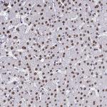 hnRNP DL Antibody in Immunohistochemistry (Paraffin) (IHC (P))