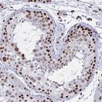 hnRNP DL Antibody in Immunohistochemistry (Paraffin) (IHC (P))