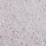 ARPP19 Polyclonal Antibody