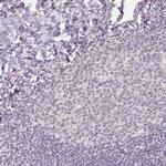 AIF1L Antibody in Immunohistochemistry (IHC)