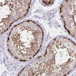 TOMM34 Antibody in Immunohistochemistry (Paraffin) (IHC (P))