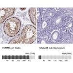 TOMM34 Antibody in Immunohistochemistry (IHC)