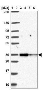 TOMM34 Antibody in Western Blot (WB)