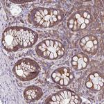 GFPT2 Polyclonal Antibody