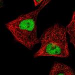 ZNF444 Polyclonal Antibody