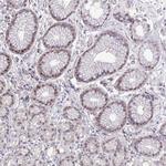 ZNF444 Antibody in Immunohistochemistry (Paraffin) (IHC (P))