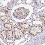 CGNL1 Antibody in Immunohistochemistry (Paraffin) (IHC (P))