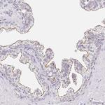 CGNL1 Polyclonal Antibody