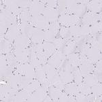 CGNL1 Antibody in Immunohistochemistry (Paraffin) (IHC (P))
